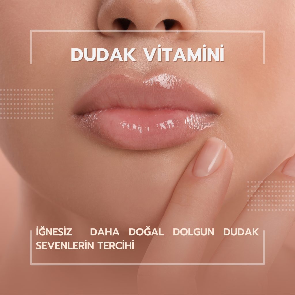 Dudak Vitamini uygulaması sonrası parlak dudaklar ve iğnesiz dolgun dudak metni.